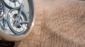 A hairy encounter - Editorial