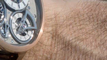 A hairy encounter - Editorial